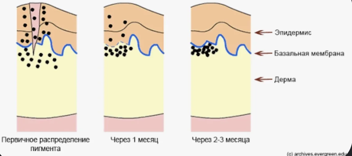 Как выглядит тату в организме